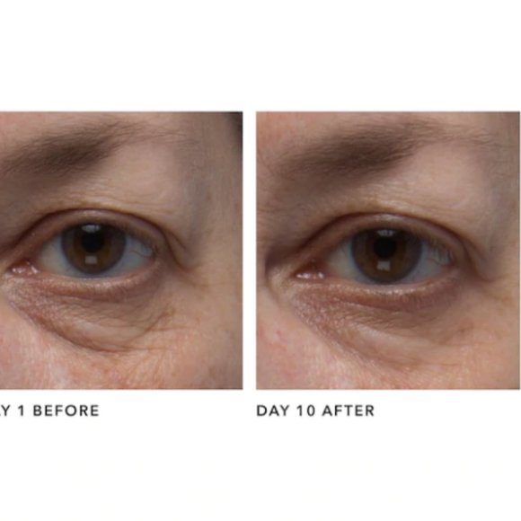 Algenist Complete Eye Renewal Balm - Picture 3 of 8